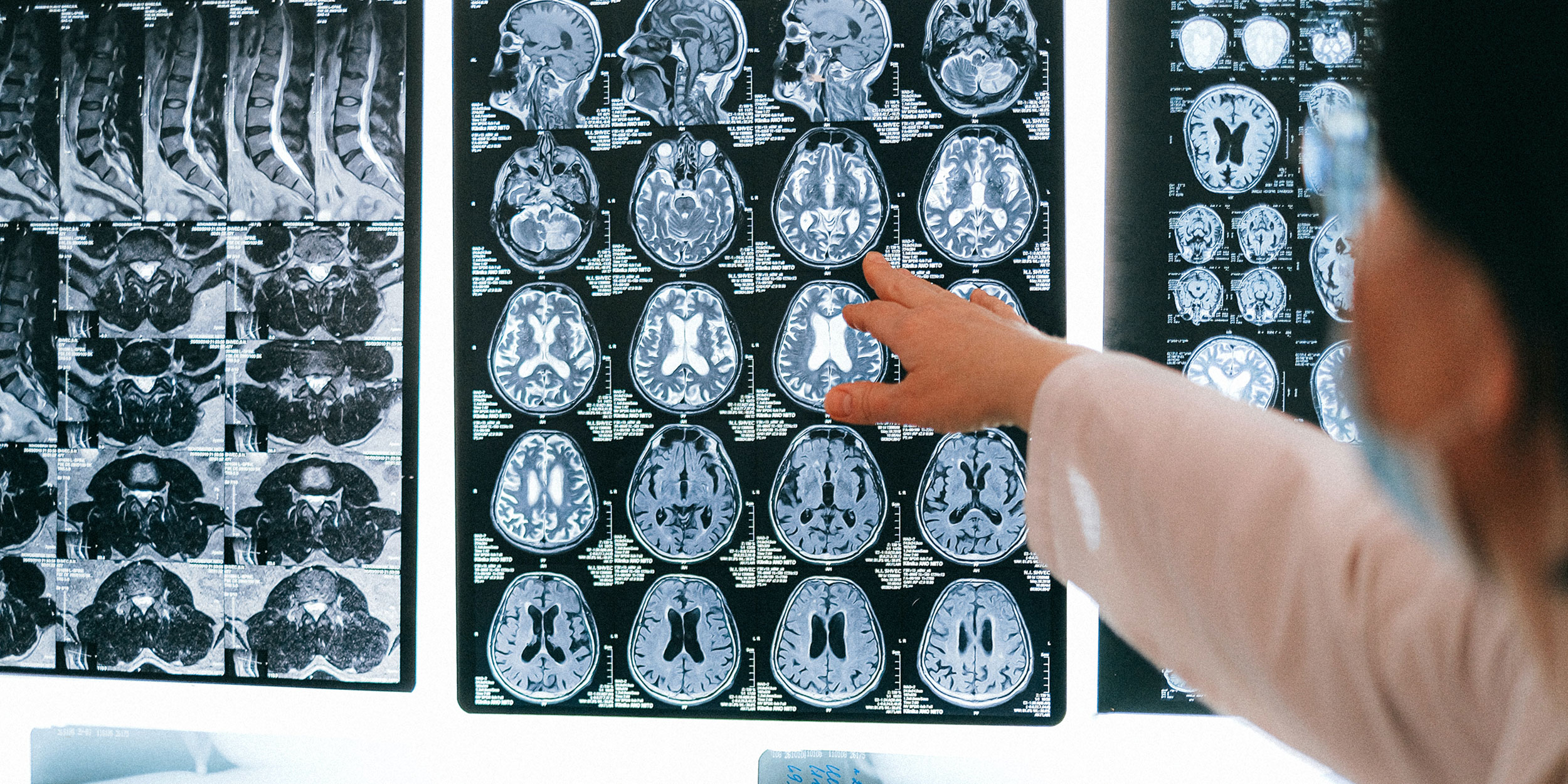 A doctor points at a screen with x-ray images on it